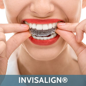 Invisalign near town2