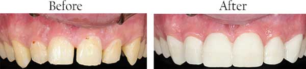 Biloxi dental images