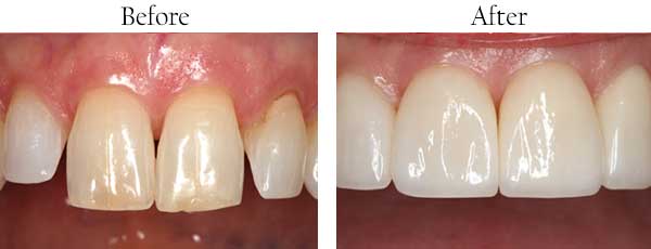 dental images 39564