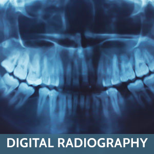 Digital Radiography town3